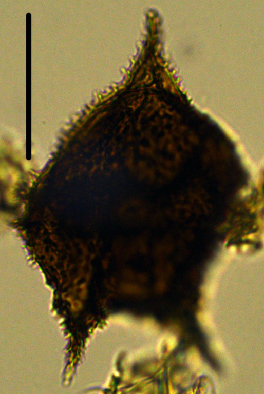 Cerodinium cpx denticulate Dde27X310121001090.jpg